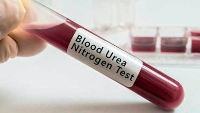 test de urea en sangre