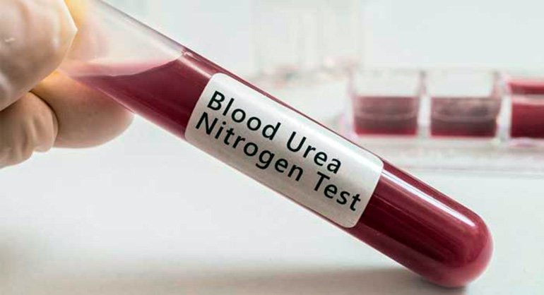 test de urea en sangre
