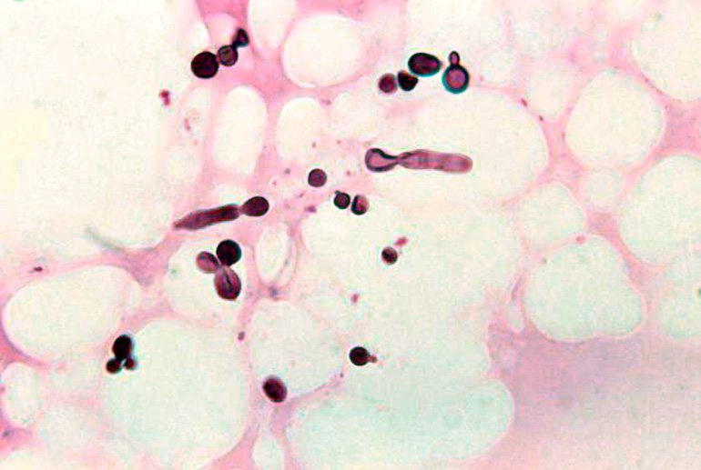 malassezia-bajo-el-microscopio