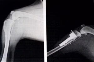 radiografia femur TTA