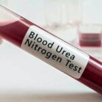 test de urea en sangre