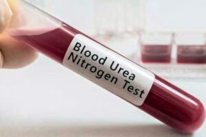 test de urea en sangre