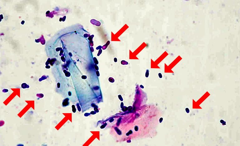 Levadura-Malassezia-bajo-el-microscopio